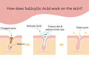 سالیسیلیک اسید و پوست